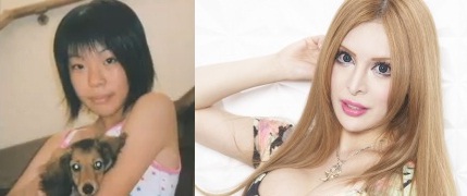 ヴァニラ整形前と比較